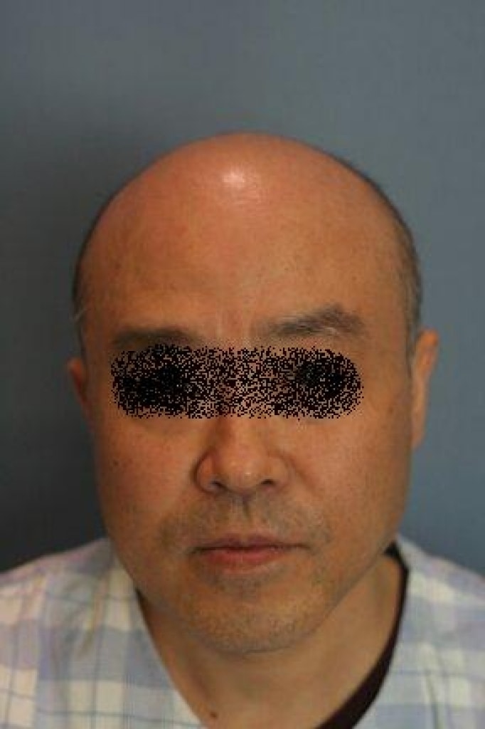 수술전2.jpg