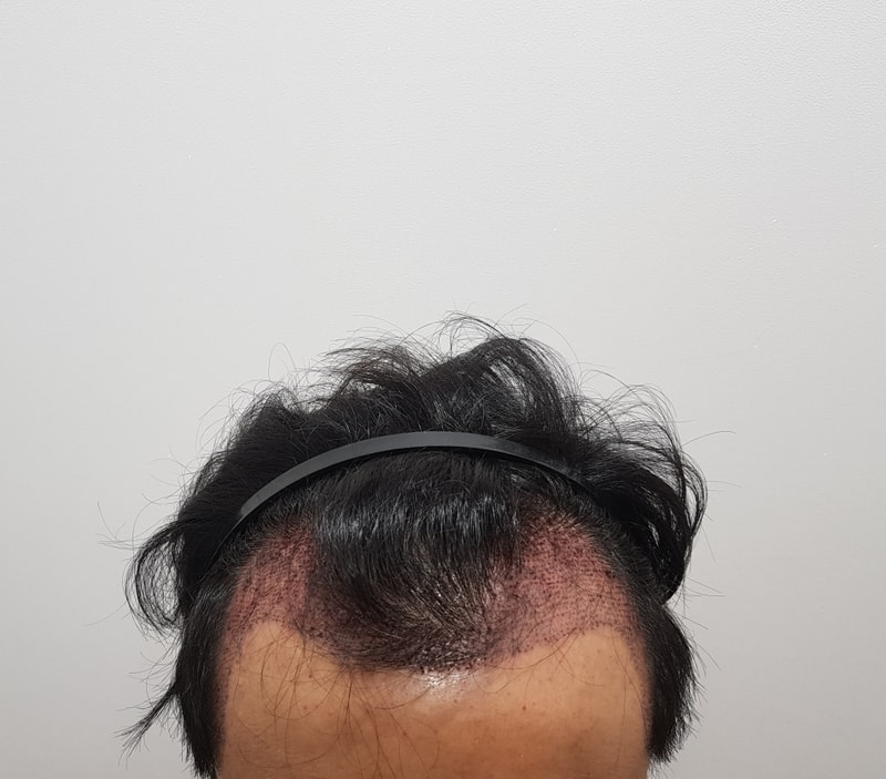 20171115_155703.jpg