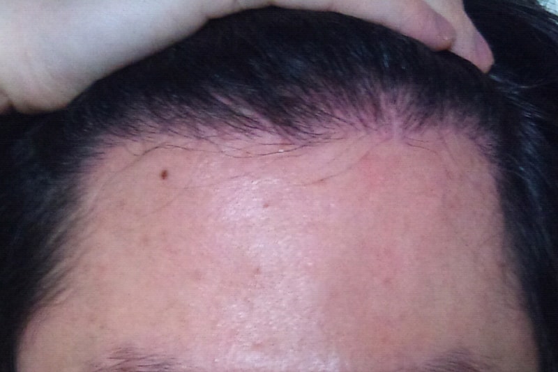 2011.03.03.jpg