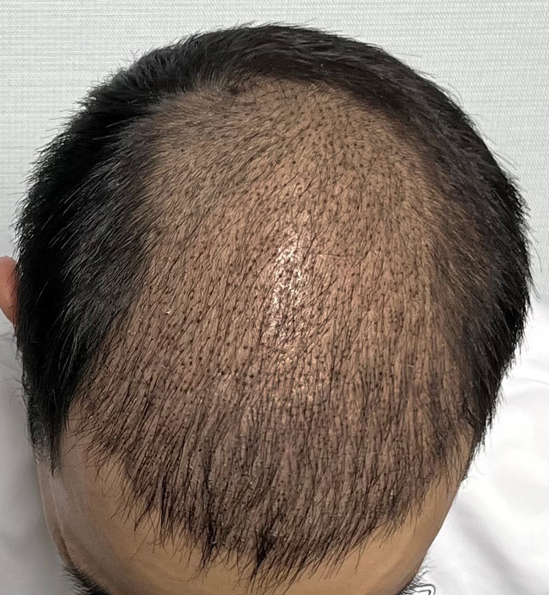 KakaoTalk_20230713_100611179_03.jpg