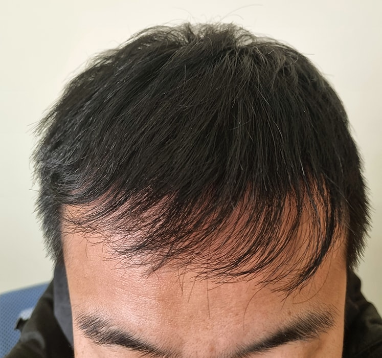 수술후01.jpg