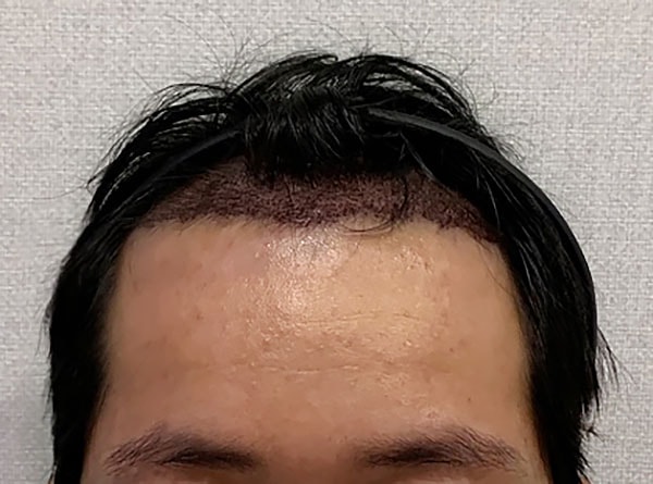수술후01.jpg