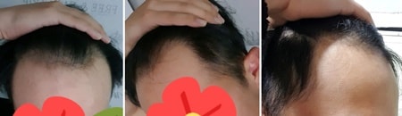 수술전_00.jpg