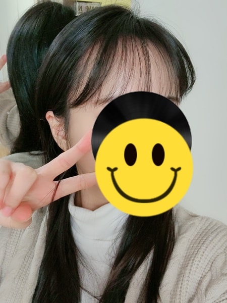 이성경수술전 셀카1.jpg