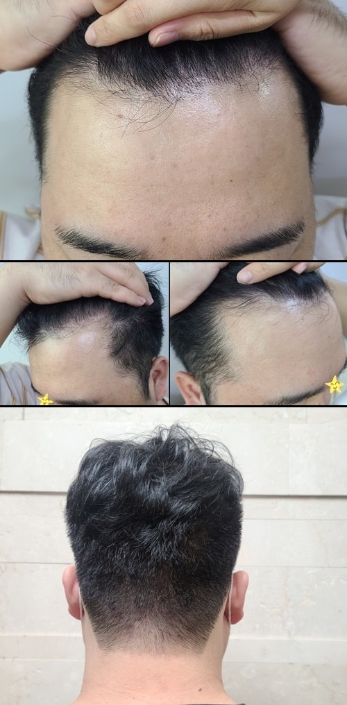 12개월차1234.jpg