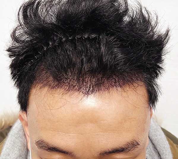 수술후01.jpg