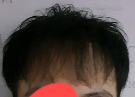 수술전_평상시.jpg