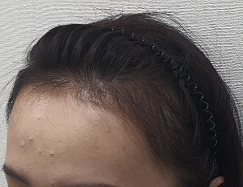 5개월차.jpg