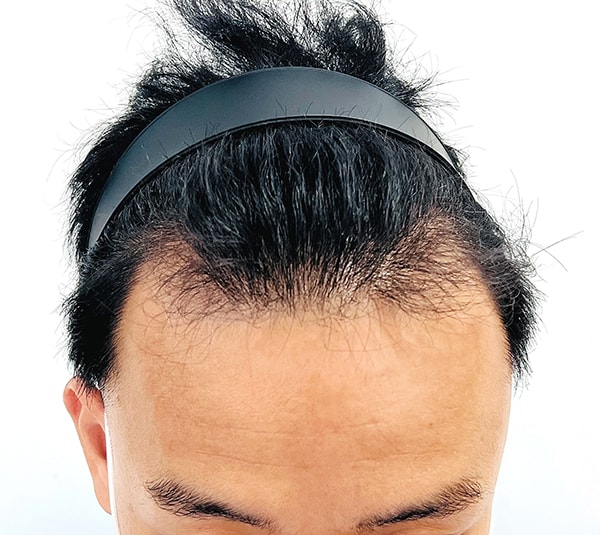 수술전01.jpg