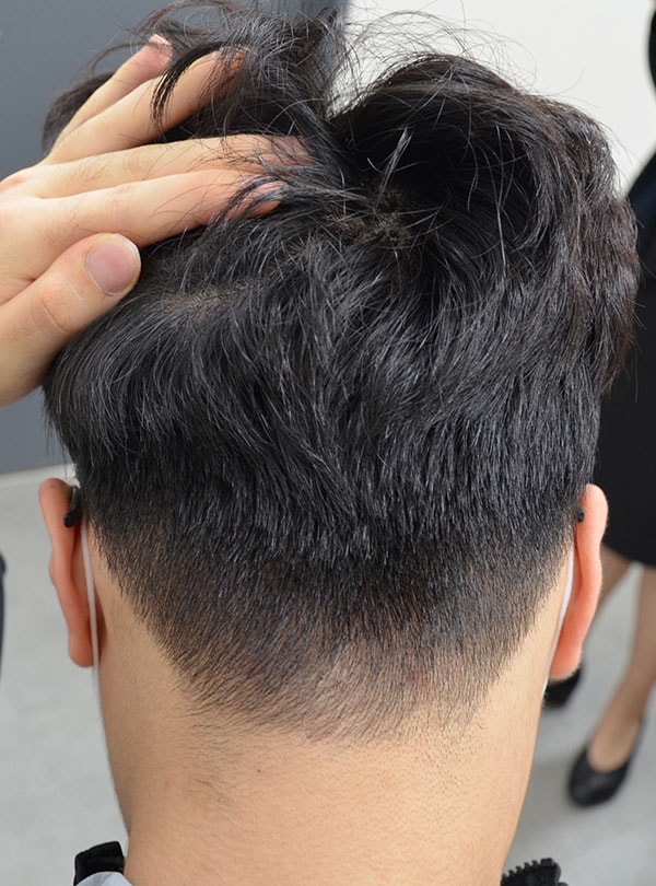 수술후03.JPG