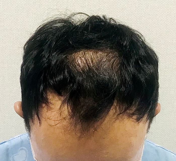 수술 전.jpg
