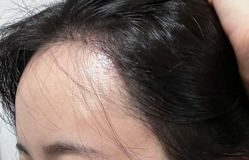 KakaoTalk_20220316_152306070_13★대다모,여우야_수술1년1개월3.jpg
