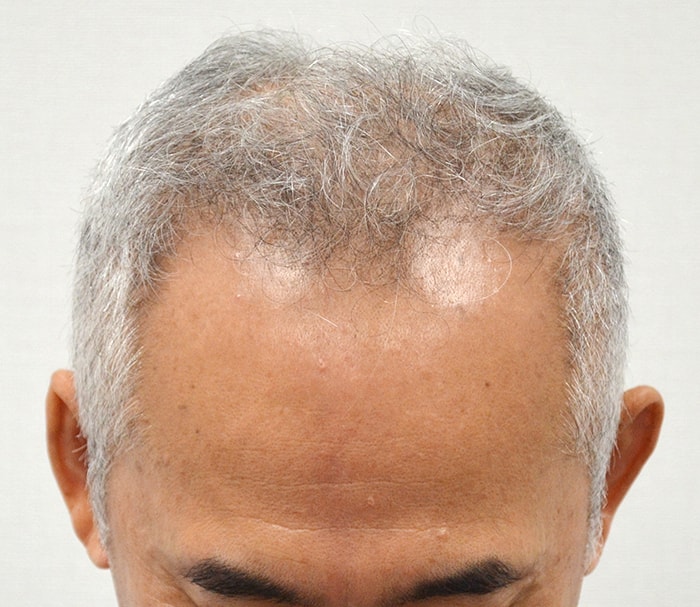 수술전.jpg