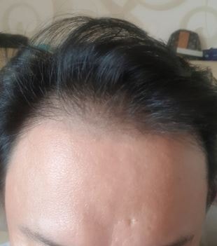 수술전1.JPG