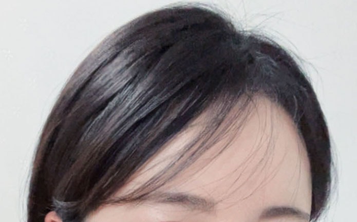 KakaoTalk_20220316_152306070_17★대다모,여우야_수술1년1개월4.jpg