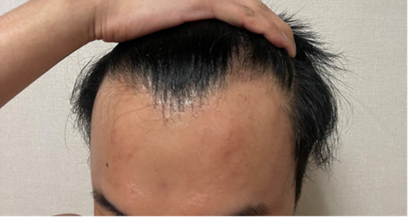 8개월차 현재1.png