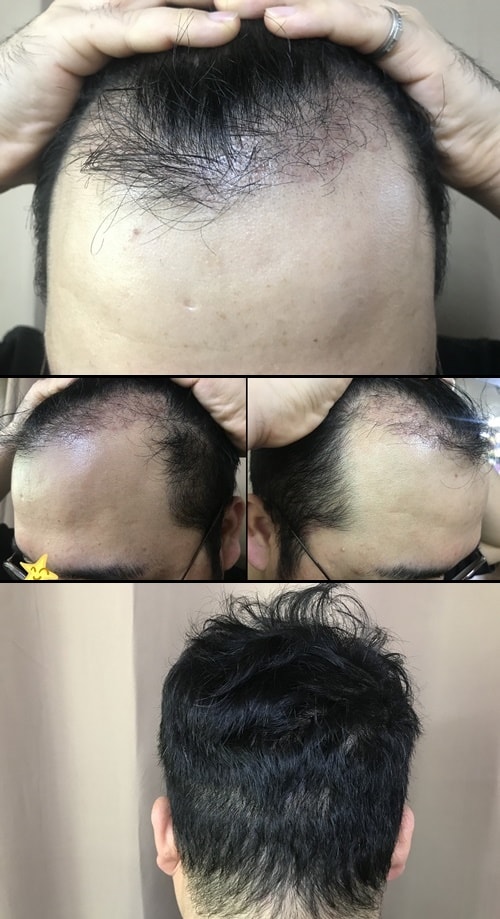 1개월1234.jpg
