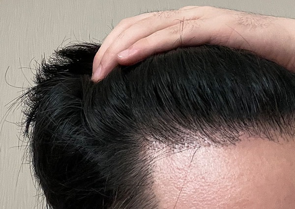 수술후01.jpg