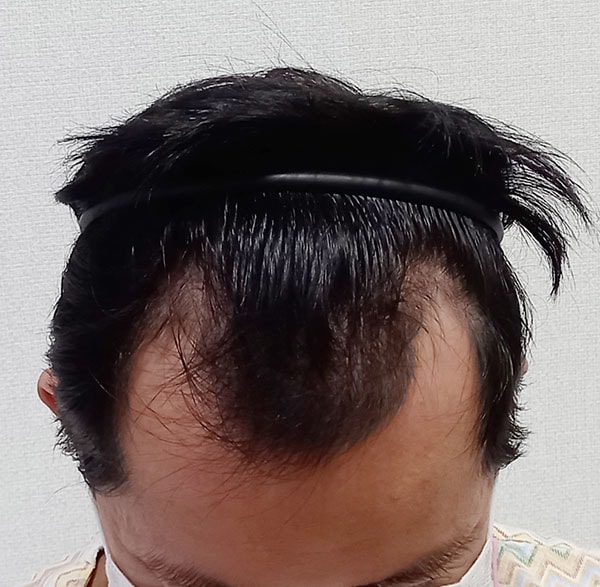 수술전02.jpg