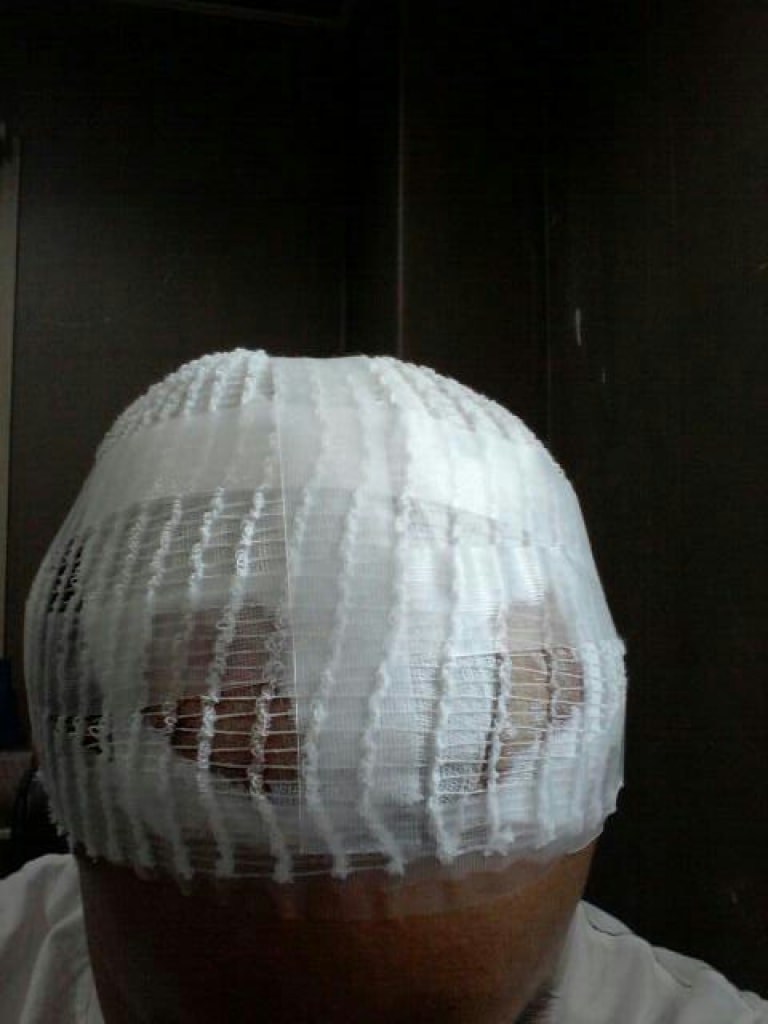 수술당일.jpg
