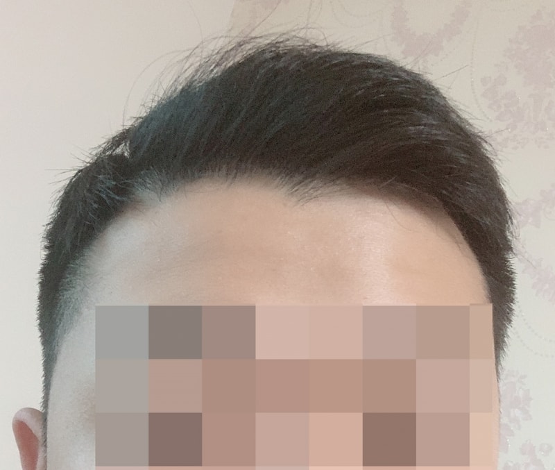 수술후01.jpg