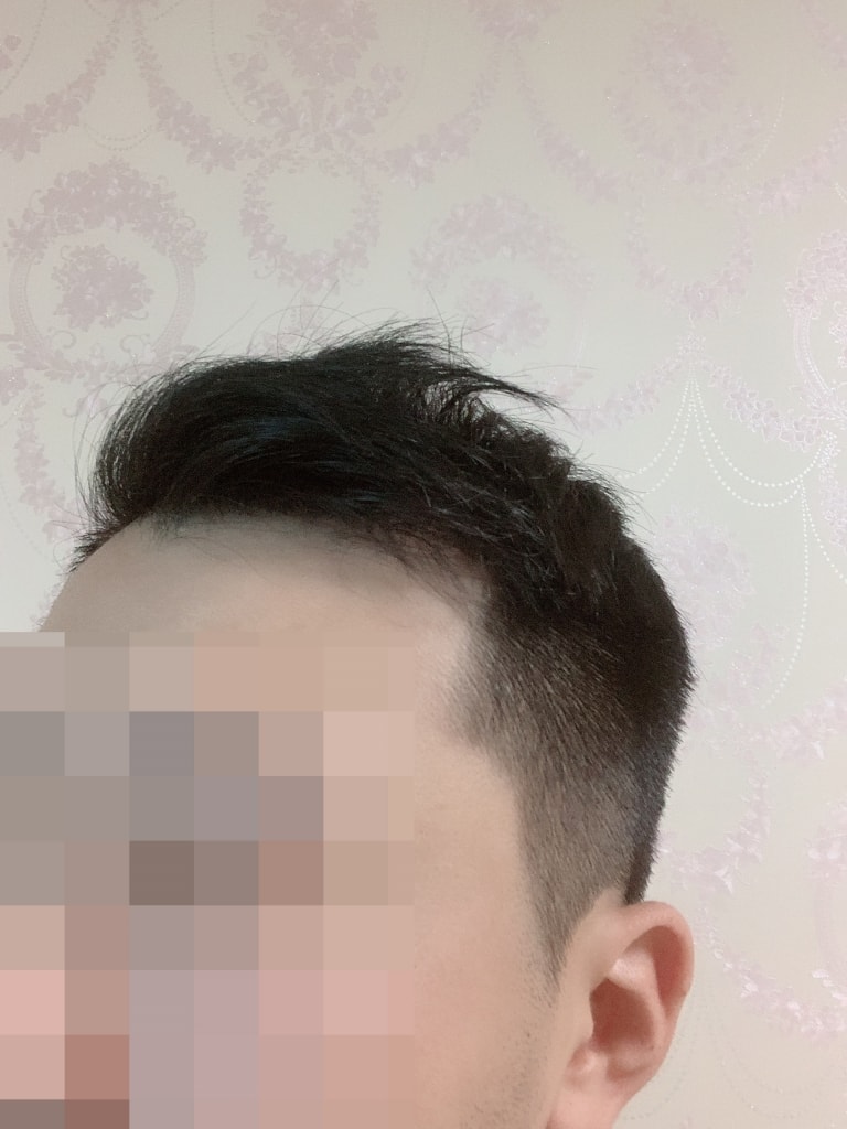 수술후02.jpg