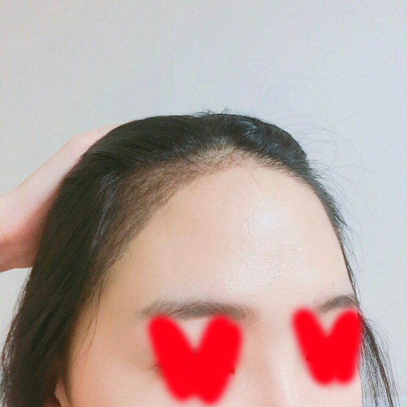 KakaoTalk_Moim_5SdY6oNQM40f7GKzs59k8vTJIwBT90.jpg