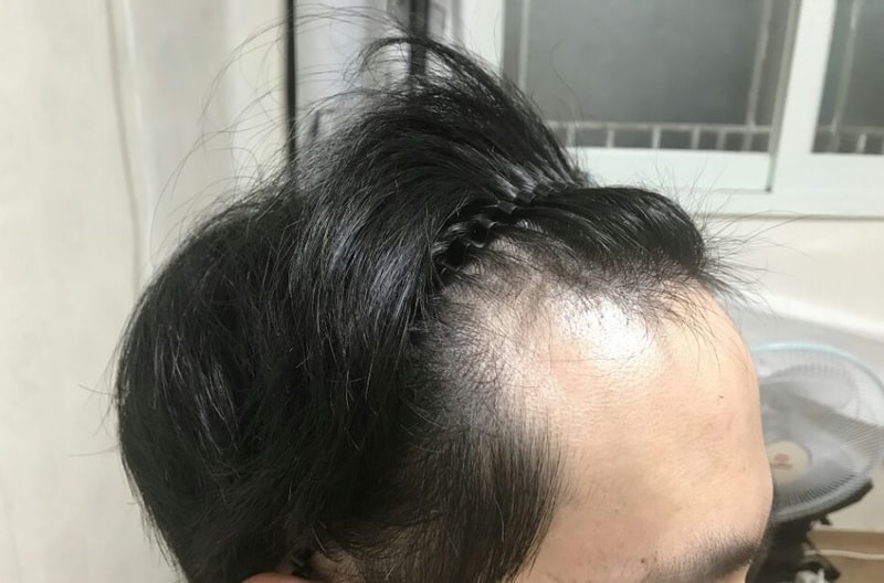 KakaoTalk_Moim_5SdY6oNQM40iDChWzJzUevRrQtikXE.jpg