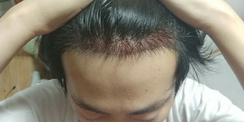 KakaoTalk_Moim_5SdY6oNQM40m1vjoBdi6uBa4ngaowN.jpg