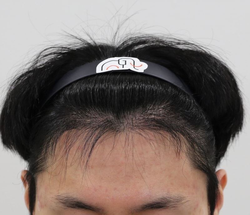 7개월 경과.jpg