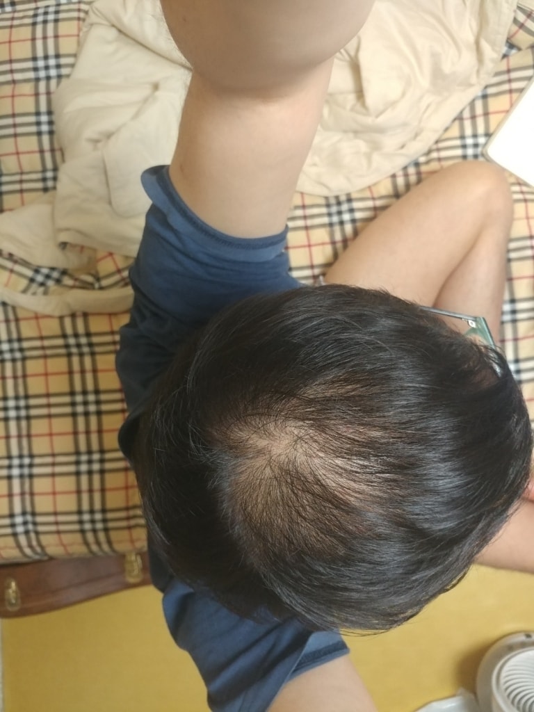 6ヶ月目の病院診療のレビューです。