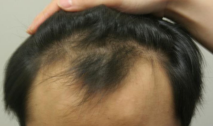 수술하기전IMG27.jpg