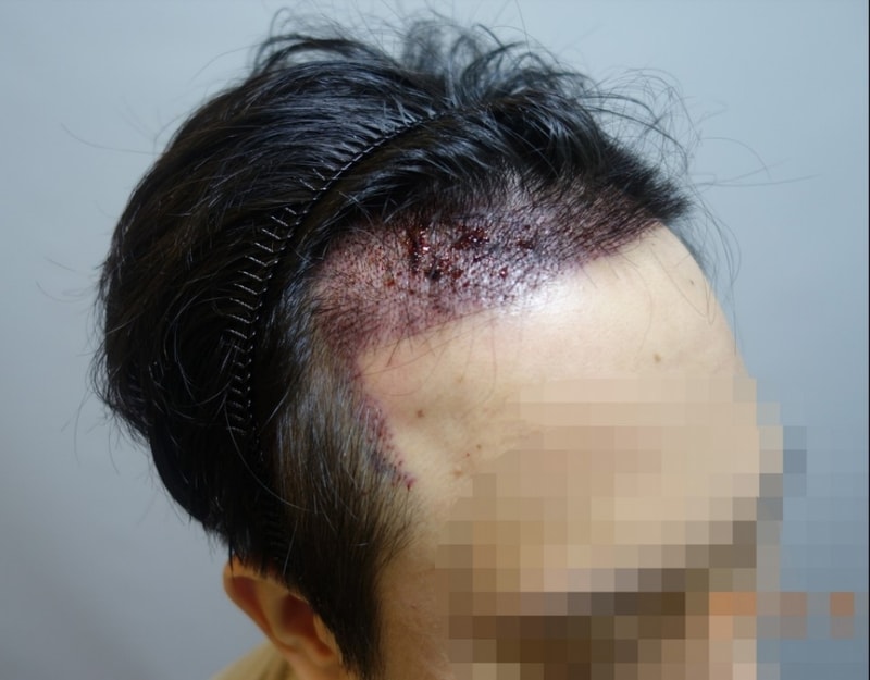 수술다음날-1.jpg