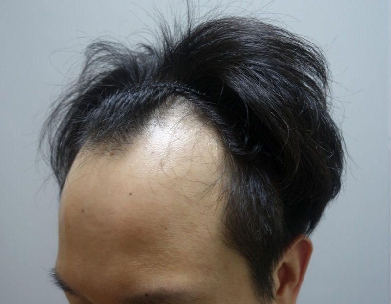 수술전-3.jpg
