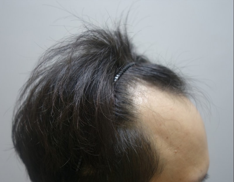 수술전-4.jpg