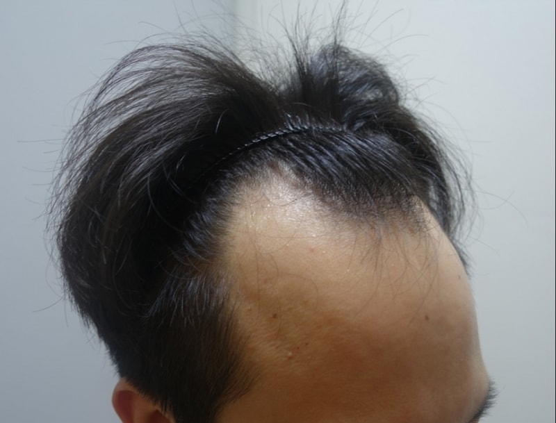 수술전-2.jpg