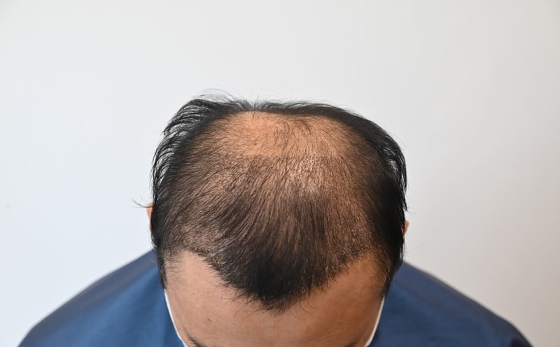 2주경과.jpg