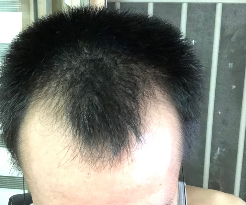 手術直後や入院室で写真を撮る