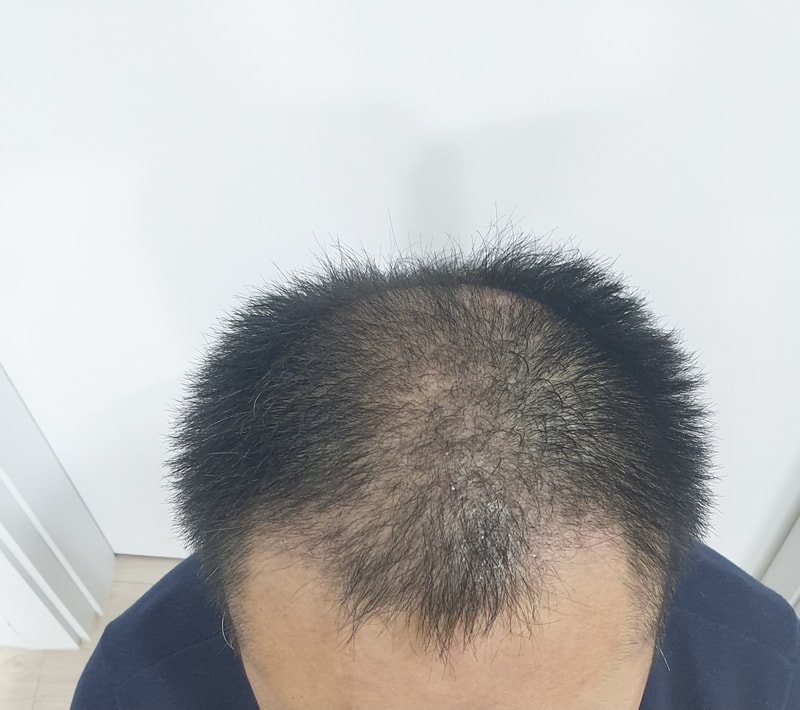 移植8千只左右迎来1个月
