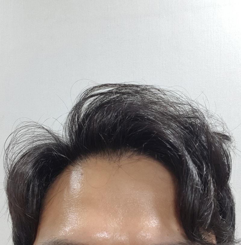 我的碎发上来了