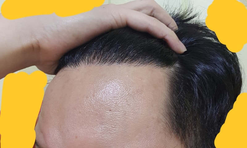20180621_205141.jpg