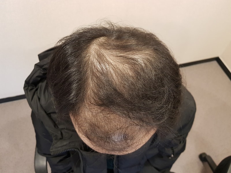 20180307_113353.jpg