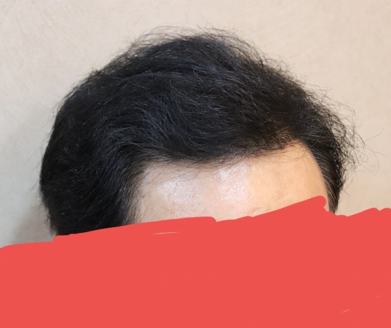 20180927_201156.jpg