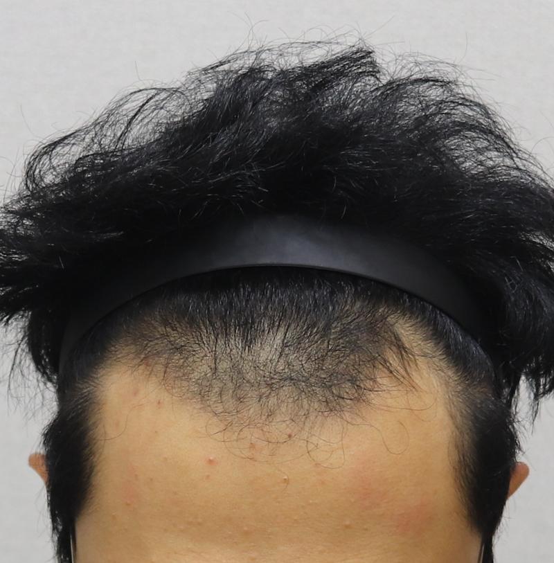 전 정면 샷.JPG