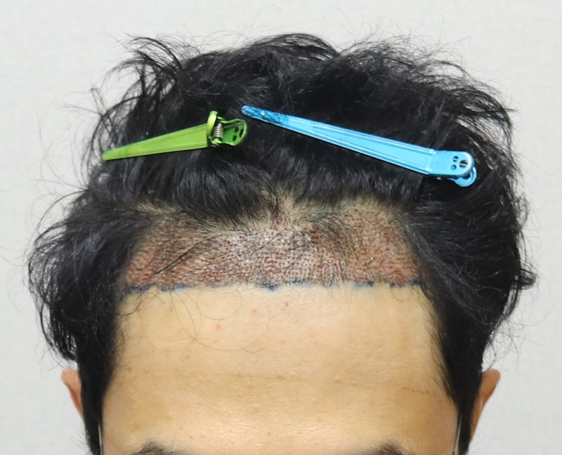 다음날 정면.JPG