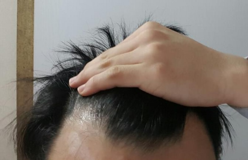 수술전2.jpg