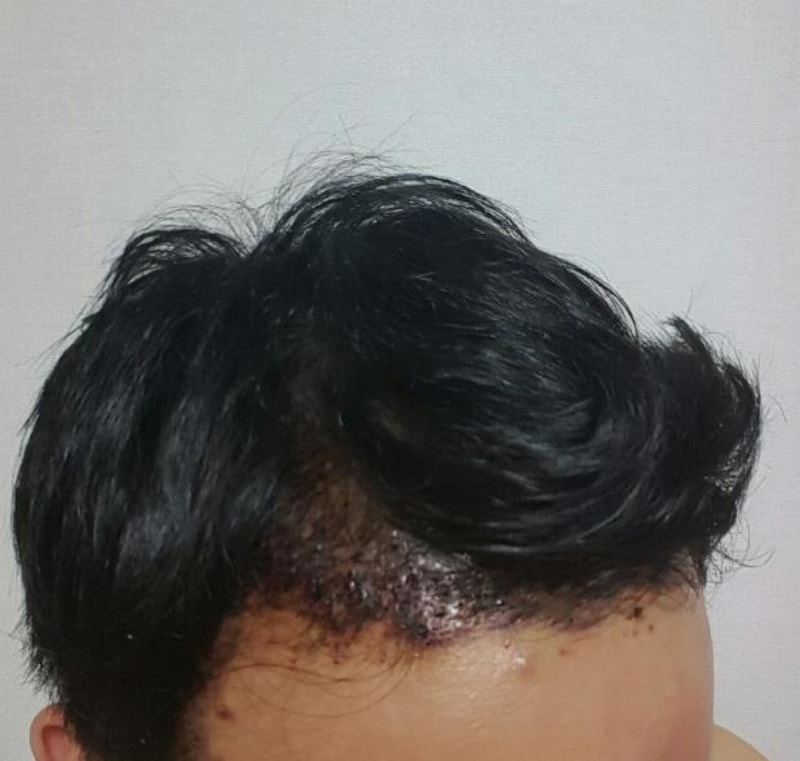 수술다음날.jpg