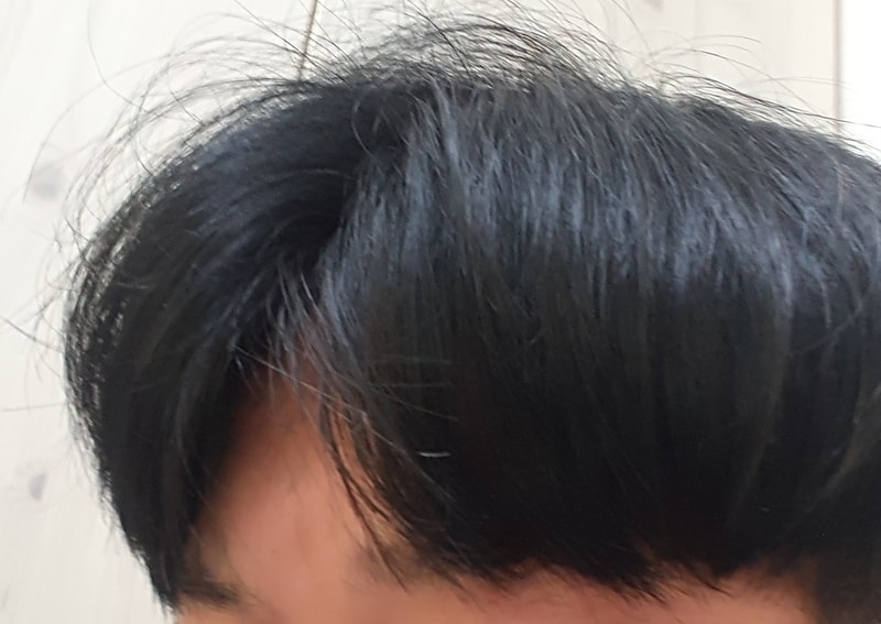 3년4개월 좌측.jpg