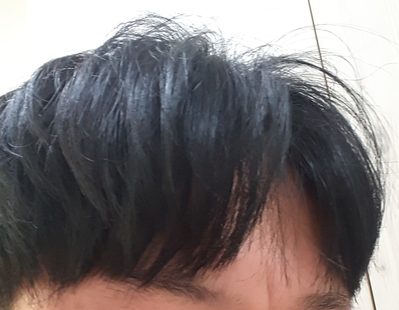 3년4개월 우측.jpg