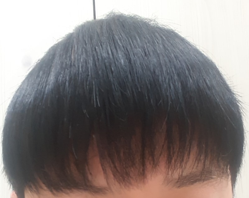 1년7개월앞머리.jpg